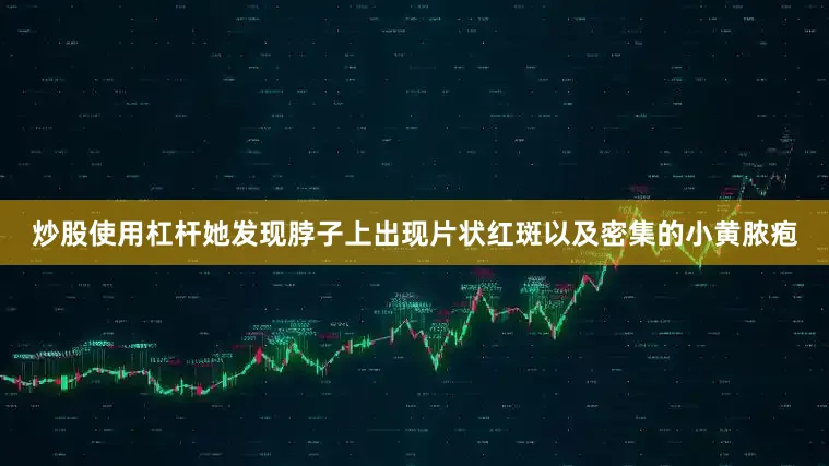 炒股使用杠杆她发现脖子上出现片状红斑以及密集的小黄脓疱